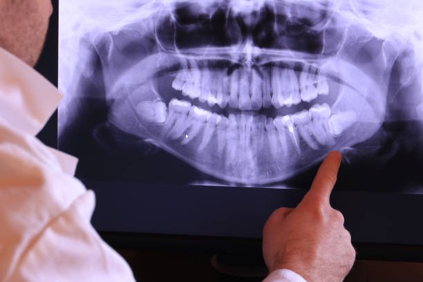 Best Walk-In Emergency Dentist in Suffern, NY